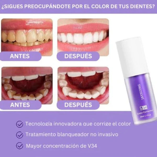 WhiteLuxe™ Transforma tu sonrisa con frescura – Whitening Formula® Oferta 2 x 1