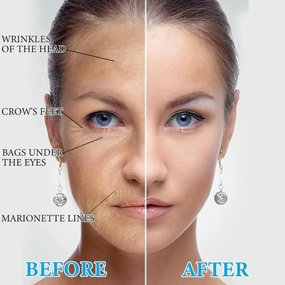 2x1 REAFIRMA Y REDUCE TU PAPADA Y ARRUGAS - Serum Botox con Colageno