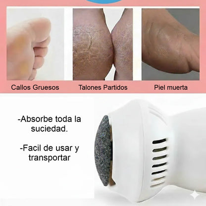 Velvet Feet Pro - Removedor de Callos Eléctrico